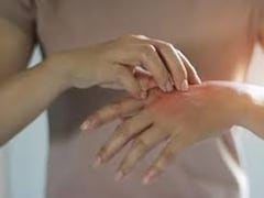 4 Skin Changes That Could Indicate Liver Disease: Top Liver Specialist Reveals