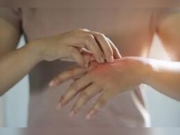 क्या आपने सोचा है खुजली करना भी हो सकता है फायदेमंद! रिसर्च में दावा बैक्टीरिया को करता है खत्म क्या आपने सोचा है खुजली करना भी हो सकता है फायदेमंद! रिसर्च में दावा बैक्टीरिया को करता है खत्म