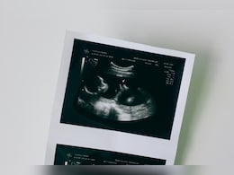 Baby Successfully Treated For Deadly Motor Neuron Diseases While Still In Womb