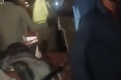 Stitches Under Flashlight: How Karnataka Man Was Treated During A Powercut Stitches Under Flashlight: How Karnataka Man Was Treated During A Powercut