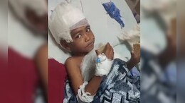 6 साल के मासूम को नोचते रहे तीन कुत्ते... शरीर में 100 से ज्यादा जख्म, इलाके में दहशत