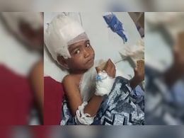 6 साल के मासूम को नोचते रहे तीन कुत्ते... शरीर में 100 से ज्यादा जख्म, इलाके में दहशत