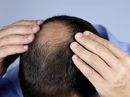 Hair Fall: बालों को झड़ना रोकते हैं ये विटामिन, जानिए किन्हें डाइट में शामिल करना है जरूरी Hair Fall: बालों को झड़ना रोकते हैं ये विटामिन, जानिए किन्हें डाइट में शामिल करना है जरूरी