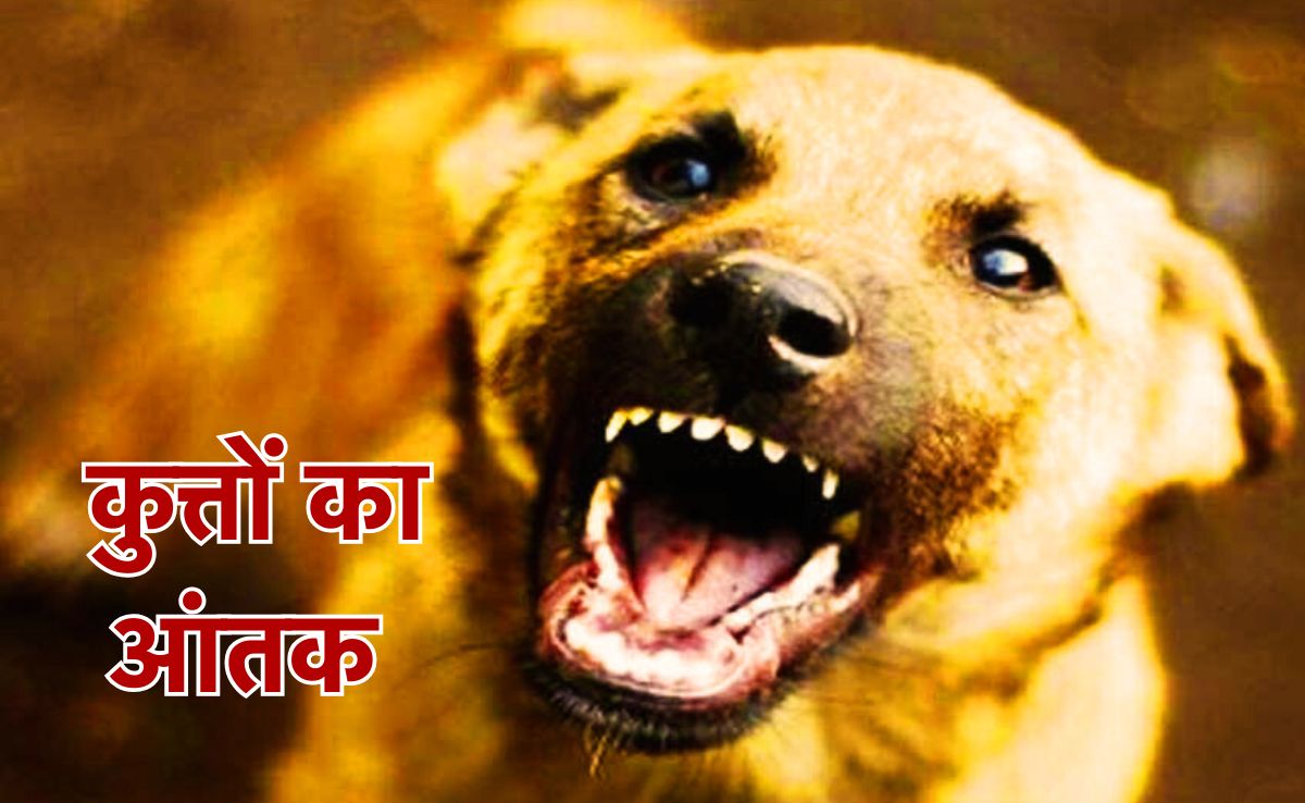 Street Dog Terror: मासूम का आधा गाल खा गया कुत्ता, चेहरे से गायब मिला मांस, नजारा देख डॉक्टर भी थर्राए!