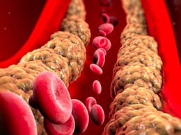 Heart Health: Simple Tweaks To Better Manage Bad Cholesterol Heart Health: Simple Tweaks To Better Manage Bad Cholesterol