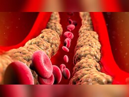 शरीर के लिए दुश्मन नहीं है कोलेस्ट्रॉल, यहां समझें पूरी गणित शरीर के लिए दुश्मन नहीं है कोलेस्ट्रॉल, यहां समझें पूरी गणित