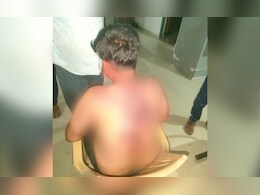 मऊगंज के बाद सीधी में हालात खराब! युवक को ग्रामीणों ने बुरी तरह पीटा, गंभीर हालत में लाया गया अस्पताल