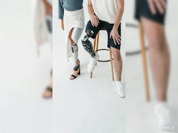 'A Leg To Stand On': Ghana Amputee Making Do-It-Yourself Prosthetics 'A Leg To Stand On': Ghana Amputee Making Do-It-Yourself Prosthetics