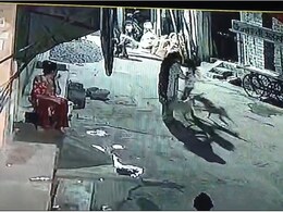 मां के सामने ही कुत्तों ने किया मासूम पर हमला, MP के शाजापुर में बढ़ा 'खूंखारों' का आंतक
