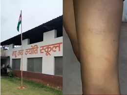 Satna: बस की सीट फाड़ने पर क्रूर सजा, स्कूल डायरेक्टर ने पीट-पीटकर उधेड़ दी छात्र की चमड़ी