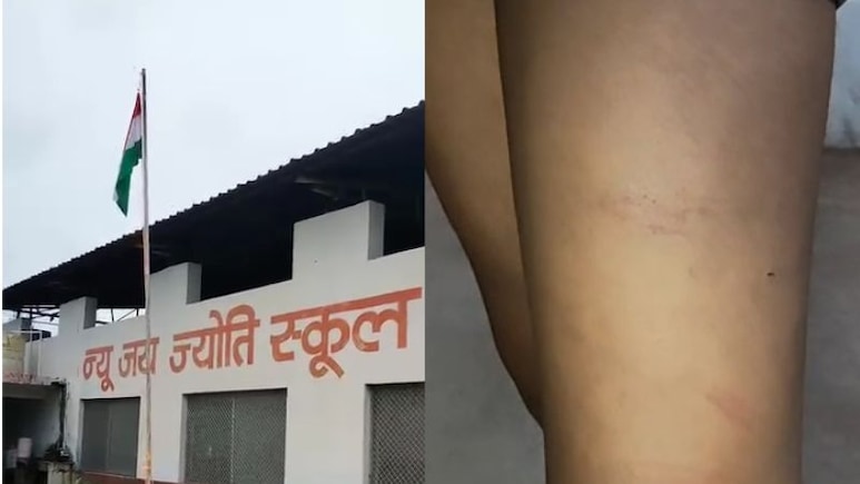 Satna: बस की सीट फाड़ने पर क्रूर सजा, स्कूल डायरेक्टर ने पीट-पीटकर उधेड़ दी छात्र की चमड़ी
