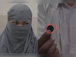 Ajmer: 4 साल की उम्र में निगल लिया था सिक्का, 16 साल बाद डॉक्टरों ने निकाला तो युवती के चेहरे पर आई मुस्कान