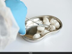 डिफेंस मिनिस्ट्री के इस वैज्ञानिक के शरीर में हैं 5 किडनी, काम करती है केवल एक, की गई ये बेहद रेयर सर्जरी