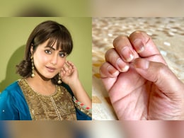 Hina Khan, Battling Cancer, On Side-Effects Of Chemotherapy: "My Nails Have Become Brittle And Dry" Hina Khan, Battling Cancer, On Side-Effects Of Chemotherapy: "My Nails Have Become Brittle And Dry"