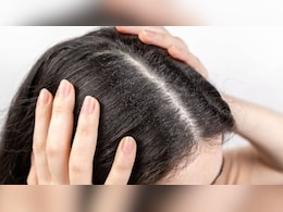 गर्मियों में बालों की सेहत पर खतरा! आयरन की कमी भी बढ़ा सकती है हेयर फॉल