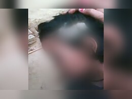 MP: टीचर ने तीसरी कक्षा की बच्ची के उखाड़ दिए बाल, फीस जमा नहीं करने पर पार की क्रूरता की हदें  MP: टीचर ने तीसरी कक्षा की बच्ची के उखाड़ दिए बाल, फीस जमा नहीं करने पर पार की क्रूरता की हदें