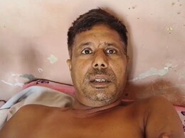 Rajasthan: लड़की के साथ रुकने के लिए नहीं दिया कमरा तो होटल मालिक पर युवकों ने फेंका खौलता दूध Rajasthan: लड़की के साथ रुकने के लिए नहीं दिया कमरा तो होटल मालिक पर युवकों ने फेंका खौलता दूध