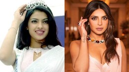 How Priyanka Chopra's Father Reacted To The Actress's Botched Nose Surgery