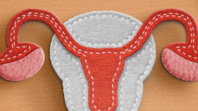 Vaccination And Early Screening Essential To Cervical Cancer Prevention, Indian Experts Share