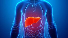 10 Early Signs Of Liver Cirrhosis & How To Prevent It