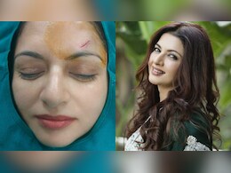 Bhagyashree Gets 13 Stitches After Injuring Her Forehead During A Game Of Pickleball
