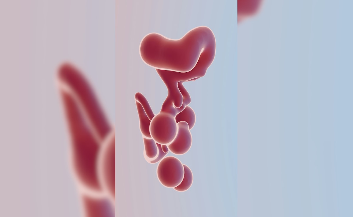 Kabj Dur Karne Ke Gharelu Upay,Pet Saaf Karne Ke Liye Kya Khana Chahie, Pet ki gandgi kaise saaf karen, Subah Pet Kaise Saaf Kare, Pet Kaise Saaf Karen, Kabj ho to kya karna chahie, 2 minute me pet saaf karne ka tarika,pet saaf kaise kare,subah pet saaf kaise karen,pet ki gandgi kaise saaf karen,kabj ho to kya karna chahie Latest and Breaking News on NDTV