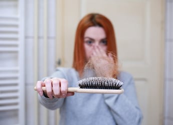 5 Key Nutrients To Combat Postpartum Hair Fall Naturally 5 Key Nutrients To Combat Postpartum Hair Fall Naturally