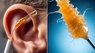 कान को 1 साल तक साफ न किया जाय तो क्या होगा? कब करनी चाहिए कान की गंदगी साफ? जानिए आसान तरीका