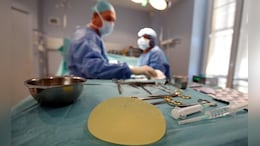 Chinese Woman Discovers Her Rs 2.8 Crore Breast Implants Contain Cattle, Moose DNA