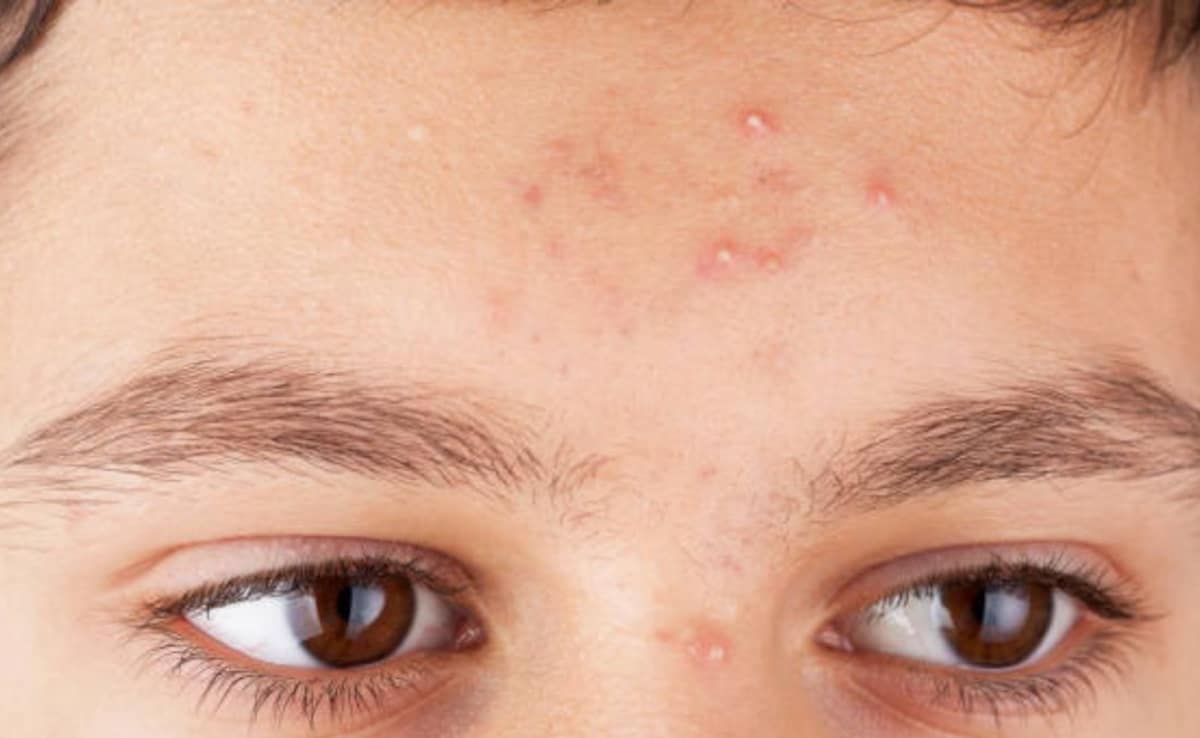 Latest and Breaking News on NDTV Latest and Breaking News on NDTV