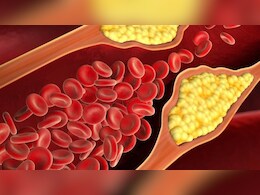 15 दिन में गंदे Cholesterol को कम कर देगी ये ड्रिंक, आयुर्वेदिक डॉक्टर ने बताया साफ हो जाएंगी बंद नसें 15 दिन में गंदे Cholesterol को कम कर देगी ये ड्रिंक, आयुर्वेदिक डॉक्टर ने बताया साफ हो जाएंगी बंद नसें