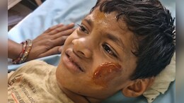 पापा के लाए बैटरी से खेल रहे थे बच्चे, अचानक हुए विस्फोट में 4 बच्चे लहूलुहान, डॉक्टर ने जताई डायनामाइट की आशंका