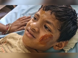 पापा के लाए बैटरी से खेल रहे थे बच्चे, अचानक हुए विस्फोट में 4 बच्चे लहूलुहान, डॉक्टर ने जताई डायनामाइट की आशंका पापा के लाए बैटरी से खेल रहे थे बच्चे, अचानक हुए विस्फोट में 4 बच्चे लहूलुहान, डॉक्टर ने जताई डायनामाइट की आशंका