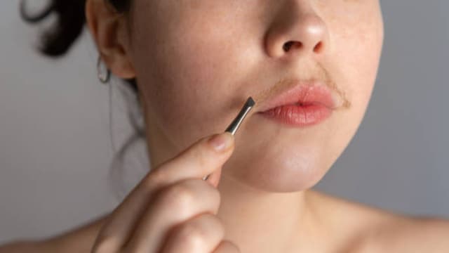 Extra hair growth on areas like the chin, upper lip, chest, back or abdomen can mean increased androgen