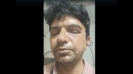 Bengaluru Professor Allegedly Beaten For Stopping Men From Throwing Garbage