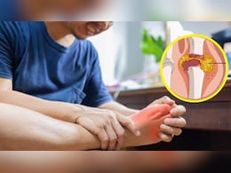 इस ड्रिंक को पीने से पेशाब के साथ बाहर आ जाएगा Uric Acid, सेलिब्रिटी न्यूट्रिशनिस्ट ने बताया बनाने का तरीका इस ड्रिंक को पीने से पेशाब के साथ बाहर आ जाएगा Uric Acid, सेलिब्रिटी न्यूट्रिशनिस्ट ने बताया बनाने का तरीका