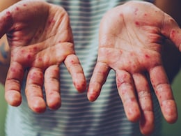 The US Is About To Lose Its Measles-Free Designation: Here's Why