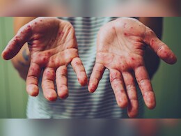 सुपरपावर अमेरिका को एक दशक बाद कैसे निशाना बना रहा खसरा? एक और बच्चे की मौत, लगभग 650 बीमार सुपरपावर अमेरिका को एक दशक बाद कैसे निशाना बना रहा खसरा? एक और बच्चे की मौत, लगभग 650 बीमार