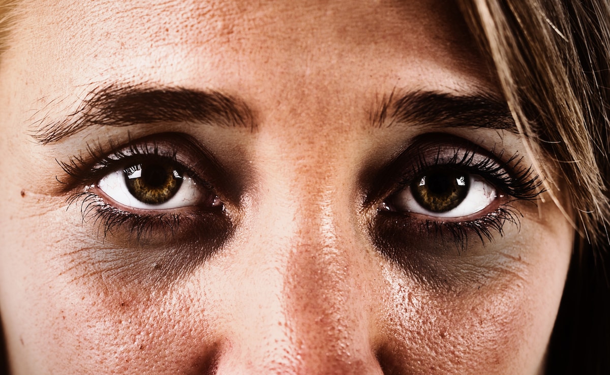 В момента в който нещо изглежда изключено с кожата ни