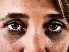 Coconut Oil For Dark Circles: क्या वाकई में डार्क सर्कल्स के लिए नारियल तेल कारगर है? यहां जानिए