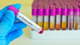 Maharashtra Family Benefits From Ayushman Bharat With Free Treatment For Blood Disorder