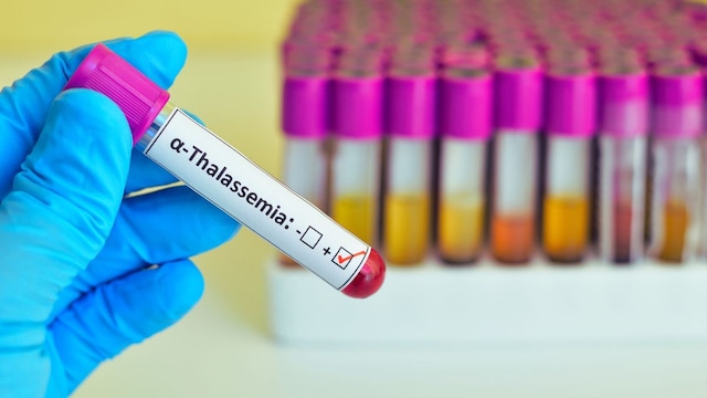 Maharashtra Family Benefits From Ayushman Bharat With Free Treatment For Blood Disorder