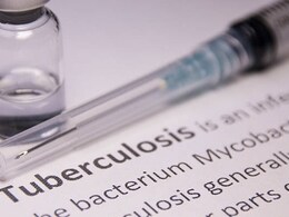 मॉलिक्यूलर स्टूल टेस्ट से HIV पीड़ित TB रोगियों का डायग्नोसिस संभव, स्टडी में हुआ खुलासा मॉलिक्यूलर स्टूल टेस्ट से HIV पीड़ित TB रोगियों का डायग्नोसिस संभव, स्टडी में हुआ खुलासा