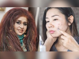 प्रेग्नेंसी में स्किन के दाग-धब्बे हटाने के लिए शहनाज हुसैन ने बताए आसान घरेलू उपाय