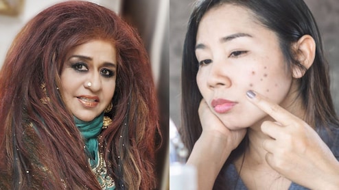 प्रेग्नेंसी में स्किन के दाग-धब्बे हटाने के लिए शहनाज हुसैन ने बताए आसान घरेलू उपाय