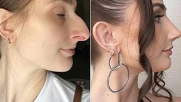 US Influencer Leaves "Miserable" Marriage After Rs 9 Lakh Nose Job Boosts Her Confidence