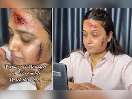 नया ट्रेंड: नकली चोट दिखाकर बॉस से ऐसे लें छुट्टी...वायरल वीडियो से मचा बवाल, सोशल मीडिया पर छिड़ी बहस नया ट्रेंड: नकली चोट दिखाकर बॉस से ऐसे लें छुट्टी...वायरल वीडियो से मचा बवाल, सोशल मीडिया पर छिड़ी बहस