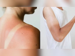 स्किन टैन हटाने के 5 असरदार घरेलू नुस्खे स्किन टैन हटाने के 5 असरदार घरेलू नुस्खे