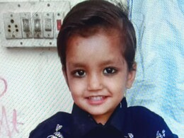 Rajasthan: 6 साल की बच्ची के चेहरे को आवारा कुत्ते ने नोच खाया, दो दिन पहले भी एक बच्ची पर हुआ था हमला