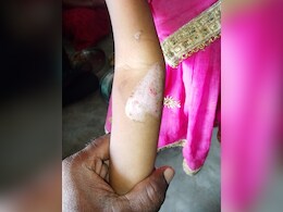 मां ने प्रेमी संग मिलकर 3 साल की बेटी का किया ये कैसा हाल, पूरे शरीर पर जलने के निशान, देखकर रूह जाएगी कांप